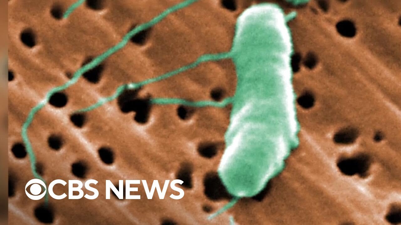 Flesh-eating bacteria kills fifth person this year in Louisiana (Video)