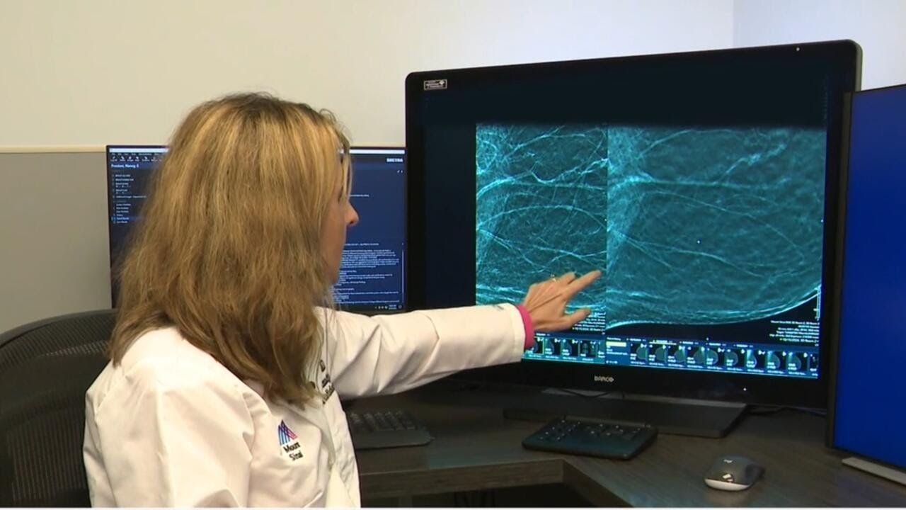 How mammograms can spot hidden signs of heart disease (Video)