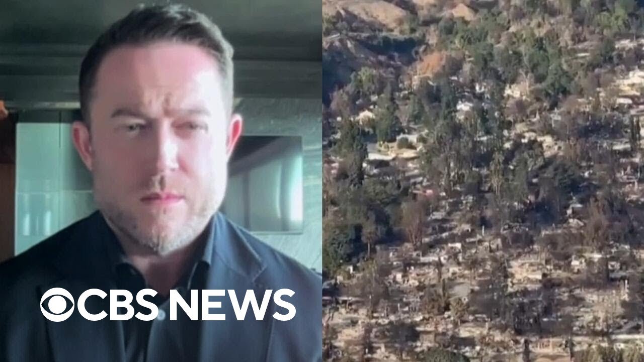 L.A. County resident on long path to recovery after wildfire (Video)