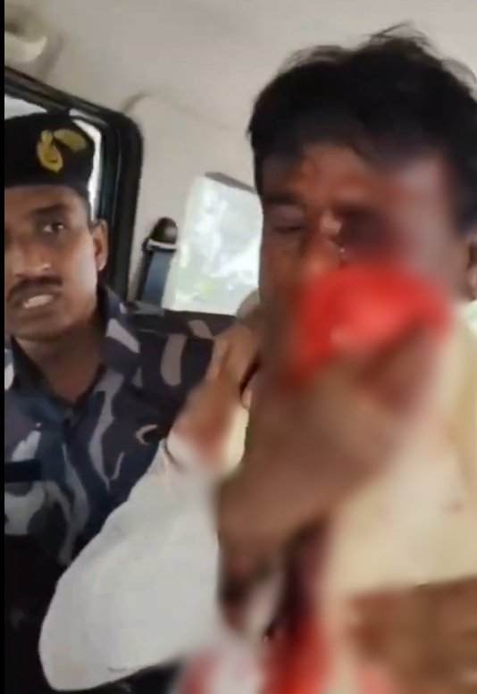 LS Speaker seeks urgent report from Bengal govt over attack on BJP MP: Kiren Rijiju