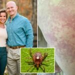 I live with alpha-gal syndrome — a tick-borne illness that makes you allergic to meat products — and my life is hell