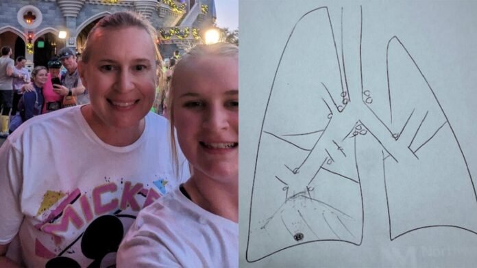 Broken limb leads to non-smoker’s lung cancer diagnosis years later (Video)