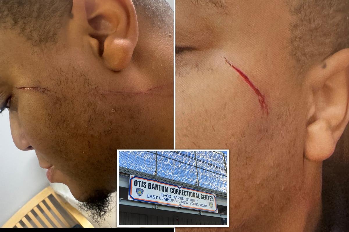 Two NYC Correction officers attacked in 4 hours at Rikers — one by menace accused of brutal subway assault: union