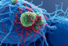 Higher intake of processed foods with preservatives may raise risk of cancer