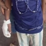 K’taka school mishap: FIR filed against BEO, teachers after Class 1 student loses fingers (Lead)