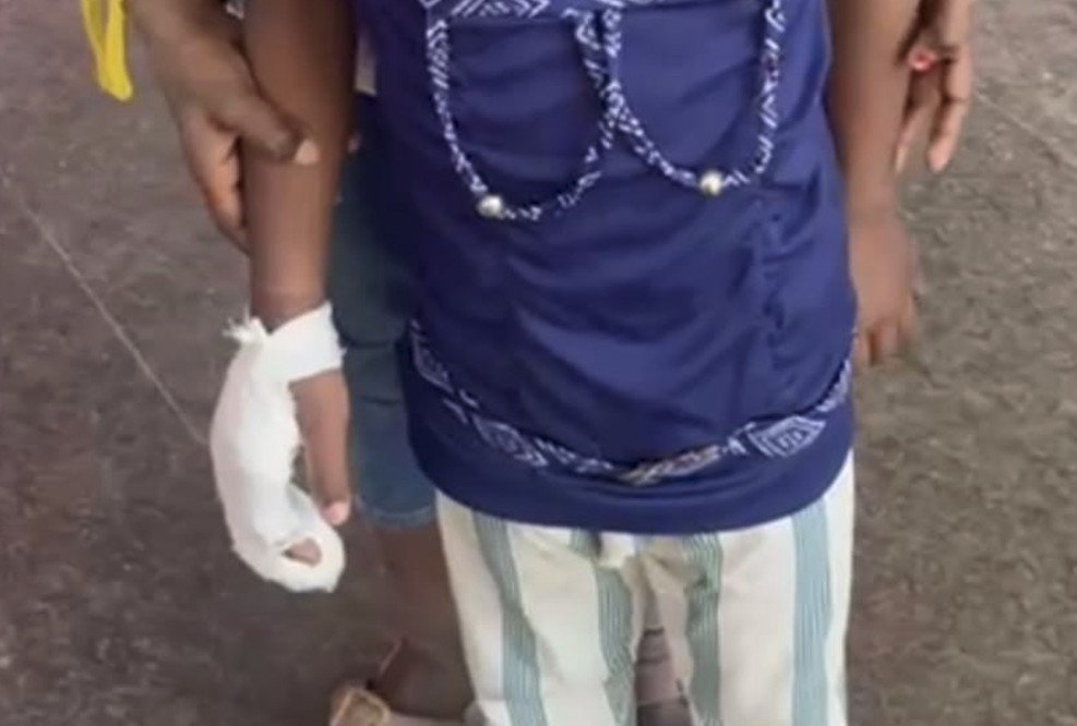K’taka school mishap: FIR filed against BEO, teachers after Class 1 student loses fingers (Lead)