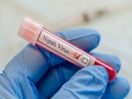 First Nipah virus death reported in Bengal